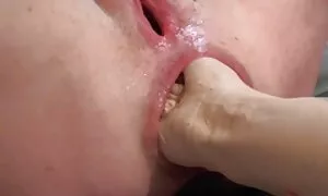 لودوچکا عکس کیرو کس و کون به سرطان مبتلا نمی شود